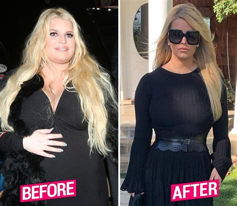 40 Celebrity Weight Loss Transformations, Before